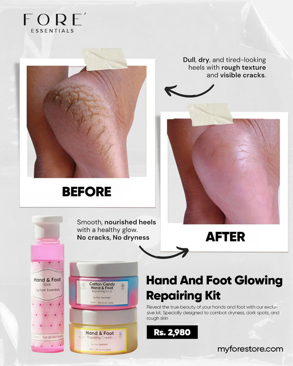 Result - Hand and Foot Kit